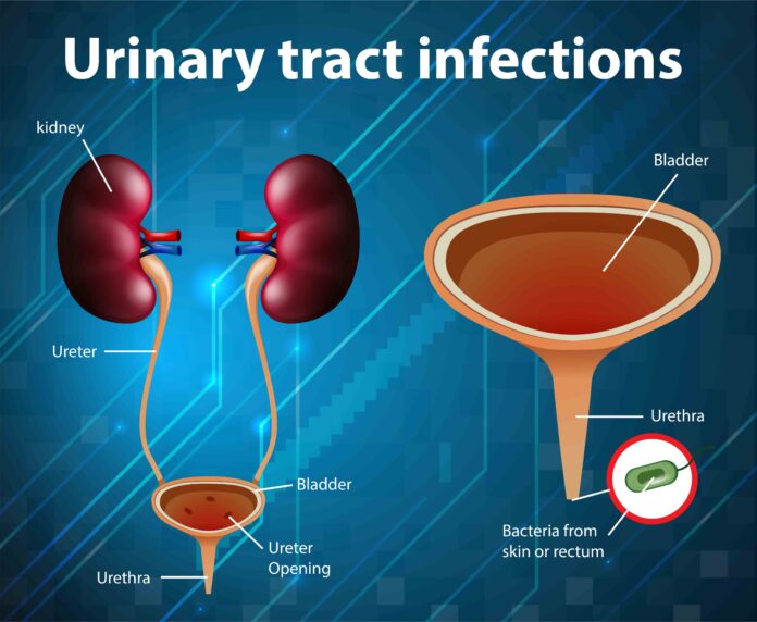 Urinary Tract Infection